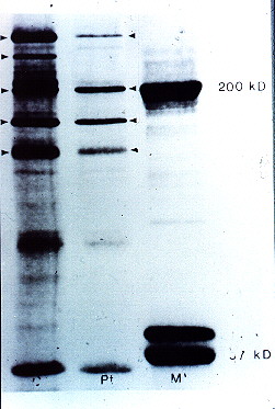 Fig. 4.- PPN Inmunofluorescencia.
