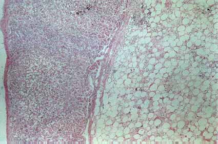 Myelolipoma, HE 40x