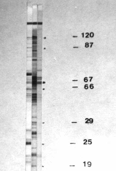 fig11