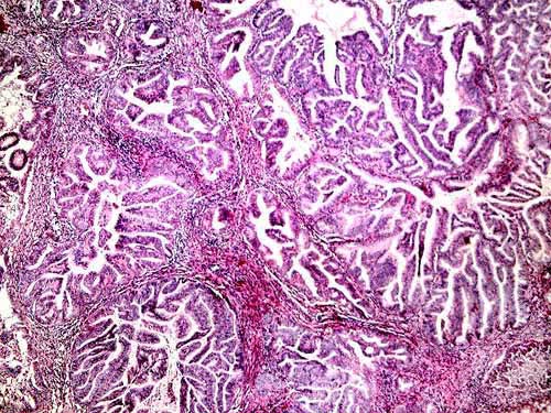 Biopsia de Endometrio - 20x