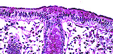 Imagen de UN CASO ESPAOL DE ESPIROQUETOSIS INTESTINAL