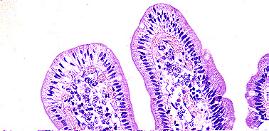 Imagen de LEISHMANIASIS EN BIOPSIA DIGESTIVA