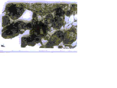 Imagen de ULTRAESTRUCTURA DEL TEJIDO HEPATICO EN PACIENTES CON ENFERMEDAD DE WILSON.