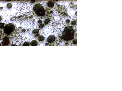 Imagen de ULTRAESTRUCTURA DEL TEJIDO HEPATICO EN PACIENTES CON ENFERMEDAD DE WILSON.