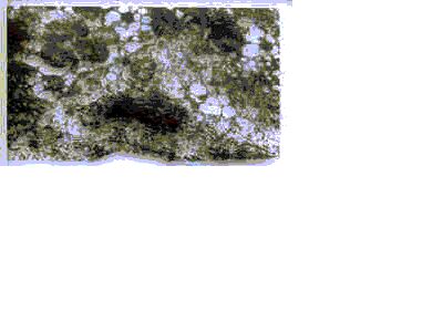 Imagen de ULTRAESTRUCTURA DEL TEJIDO HEPATICO EN PACIENTES CON ENFERMEDAD DE WILSON.