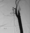 Pulse para agrandar la imagen