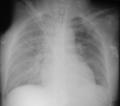 Pulse para ver una imagen ampliada (13 K)